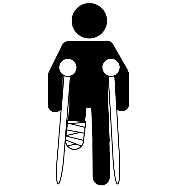 amputation