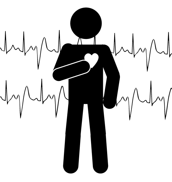 irregular heartbeat